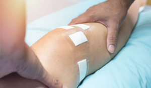 Managing and Treating Dark Surgical Scars