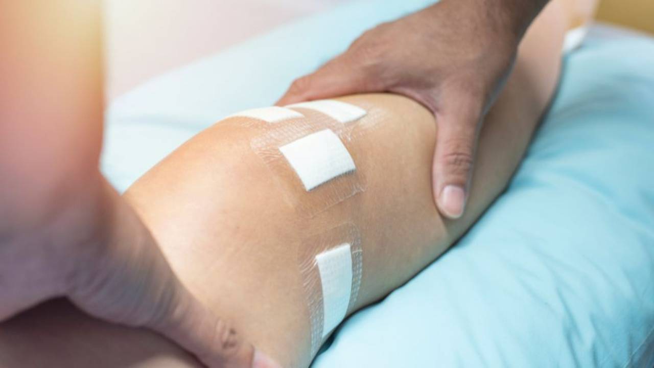 Managing and Treating Dark Surgical Scars